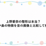 上野愛奈の整形は本当？顎や鼻の特徴を昔の画像と比較して検証